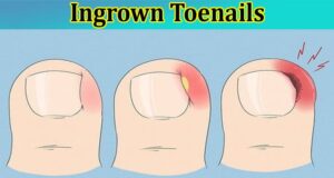 Get Rid of Your Ingrown Toenails Once and For All with Surgery